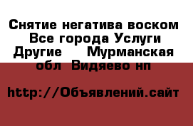 Снятие негатива воском. - Все города Услуги » Другие   . Мурманская обл.,Видяево нп